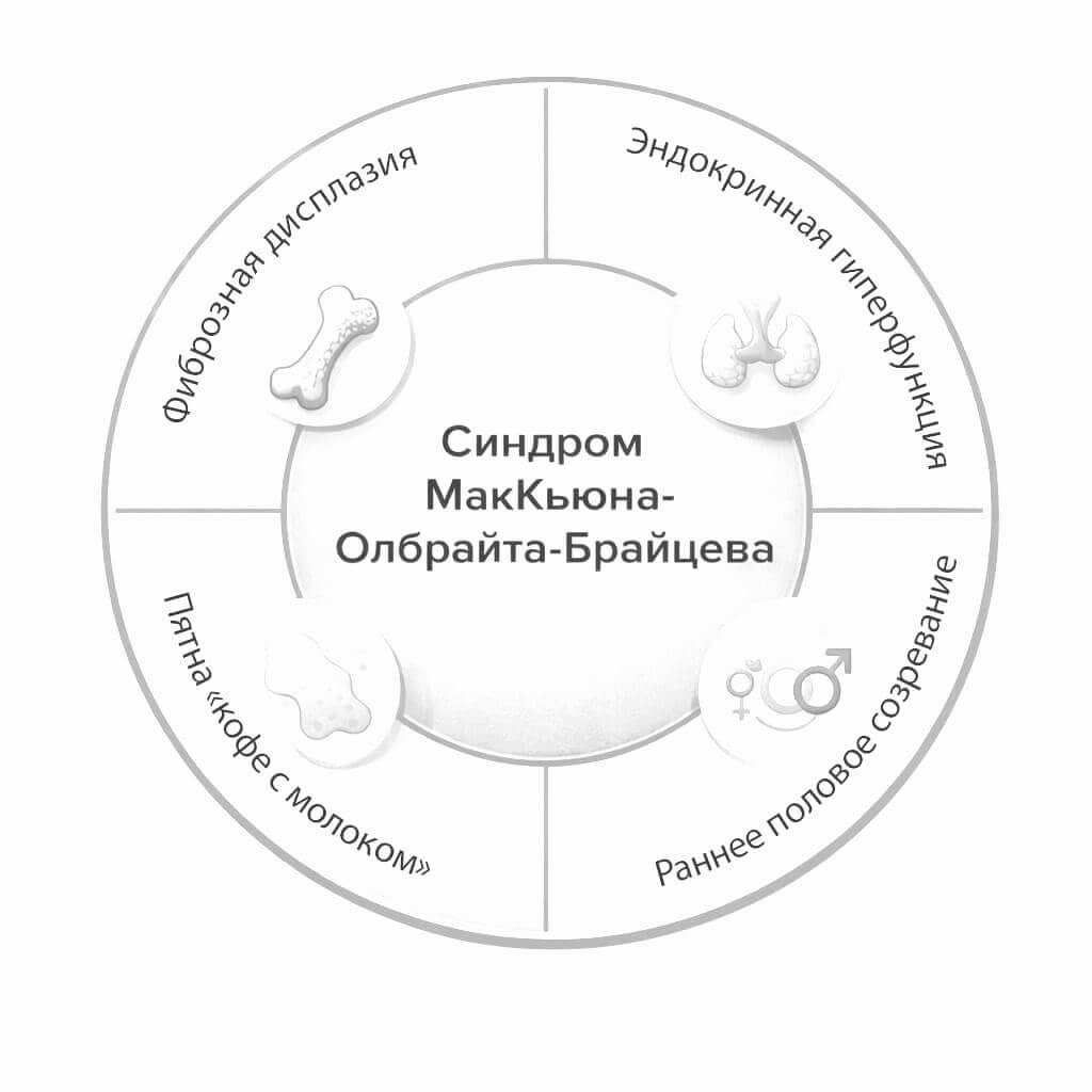 Синдром МакКьюна — Олбрайта — Брайцева